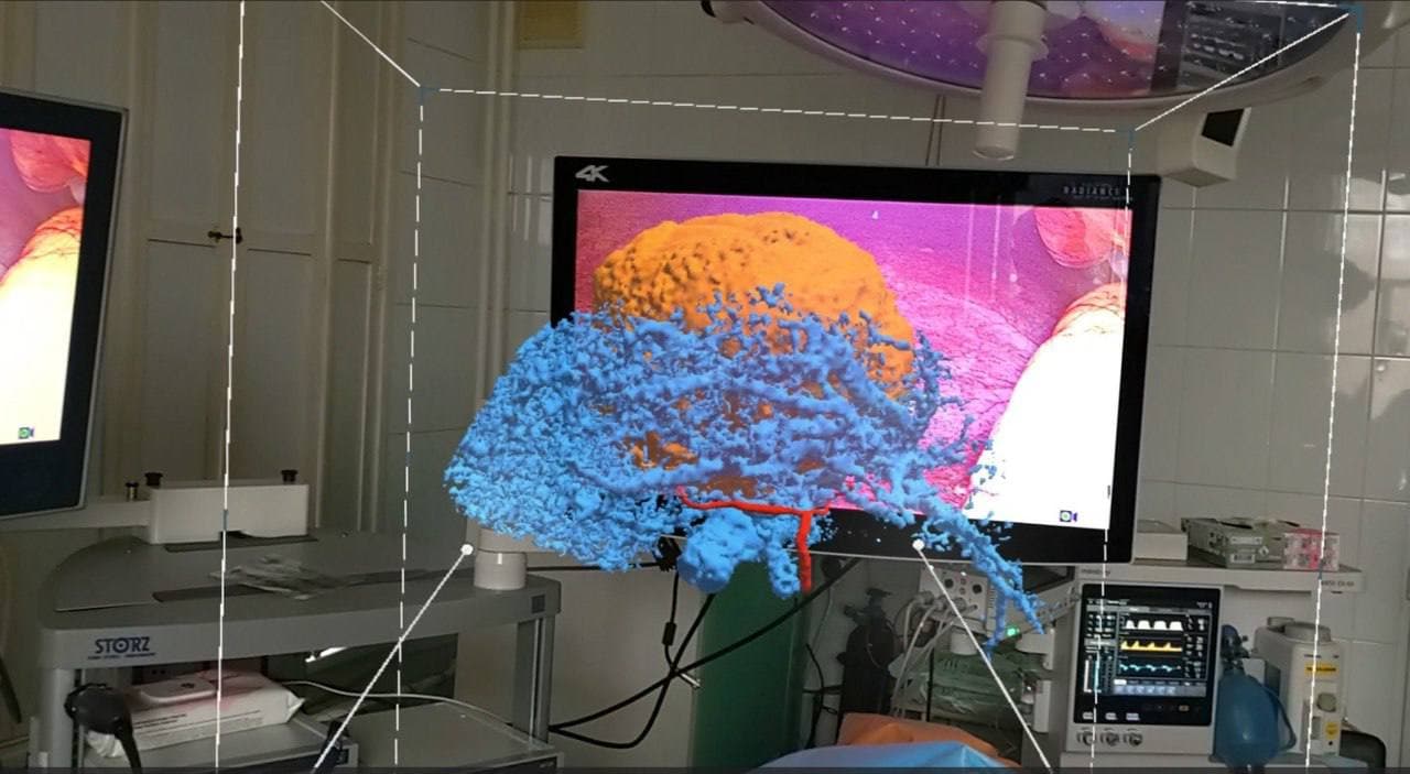 Russia Performs First-Ever Liver Surgery Using ICG Navigation and Augmented Reality